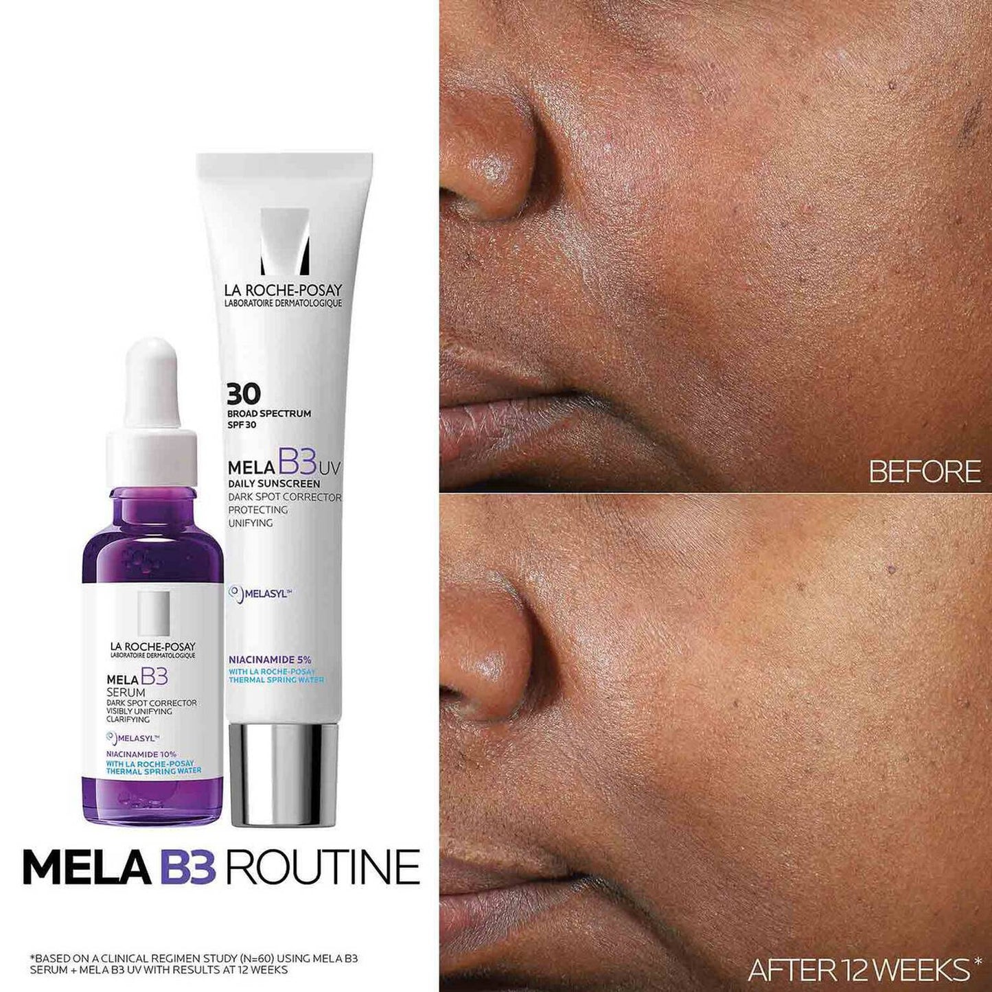 mela-b3-dark-spot-serum-and-mela-b3-uv-daily-moisturizer-with-spf-30-k1 3-Mela-B3-routine_1500X1500.jpg