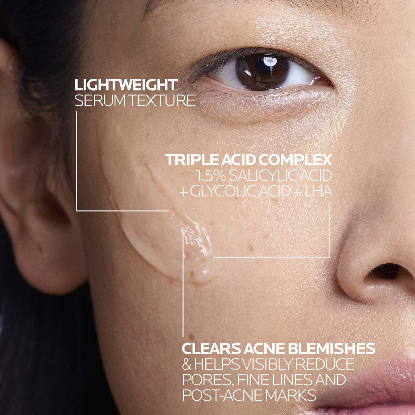 effaclar-salicylic-acid-acne-treatment-serum-r0 LaRochePosay-Product-Effaclar-Effaclar-Serum-30ml-3337875722827-Texture-REV.jpg