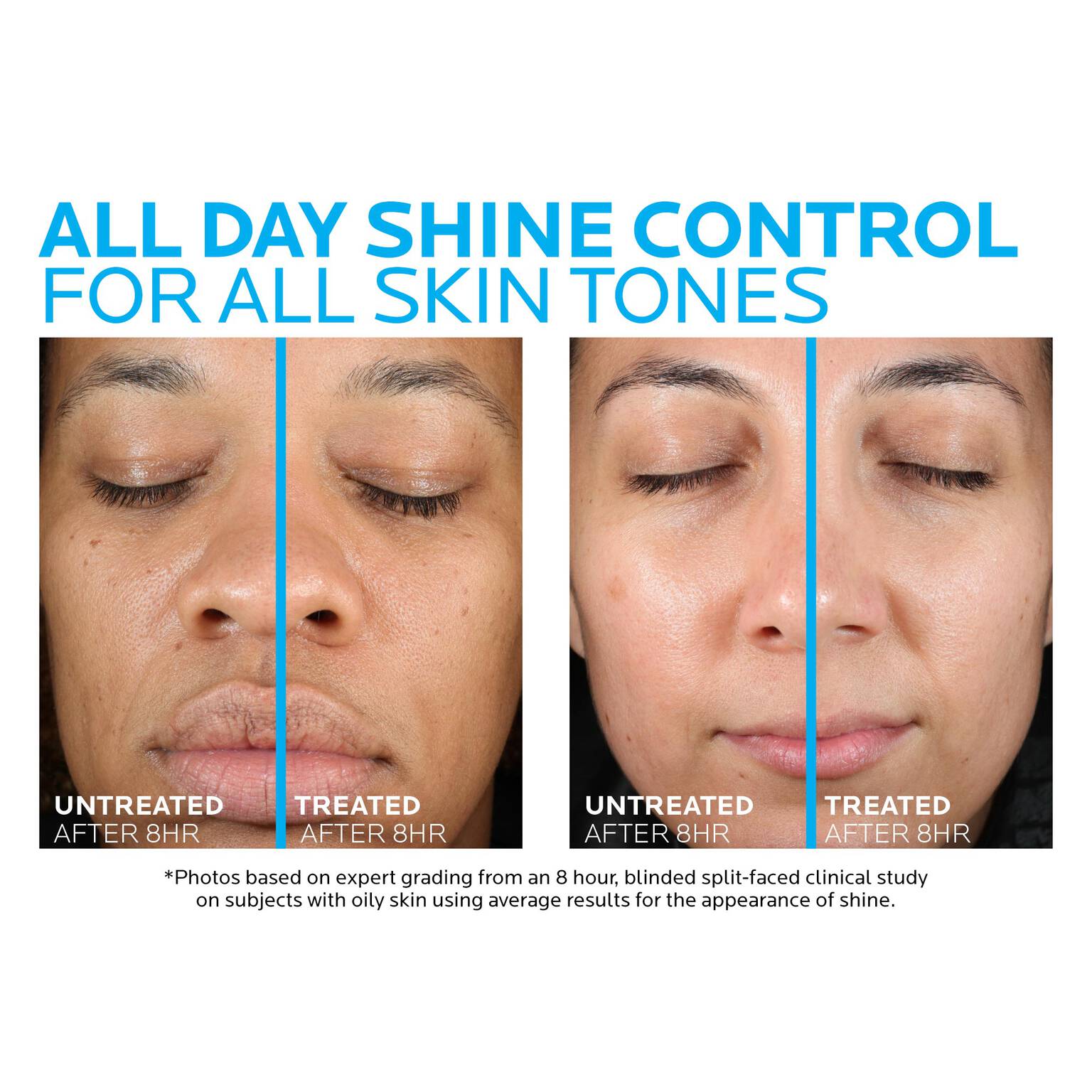 toleriane-double-repair-matte-face-moisturizer-for-oily-skin-o6 la-roche-posay-toleriane-matte-moisturizer-before-and-after-pdp-alt.jpg